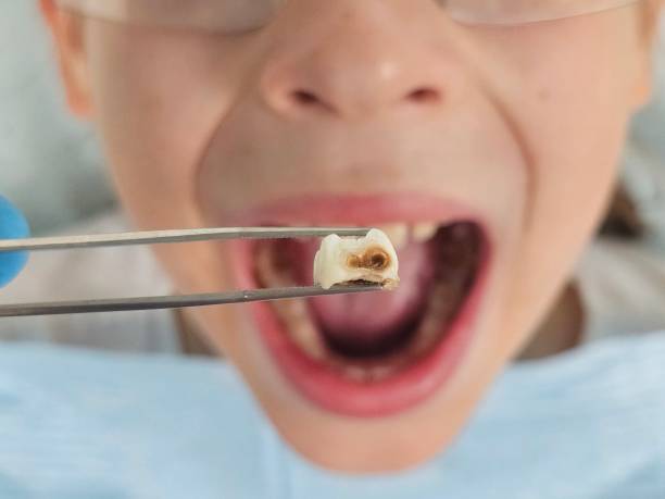 Best 24-Hour Emergency Dental Care in Oskaloosa, IA